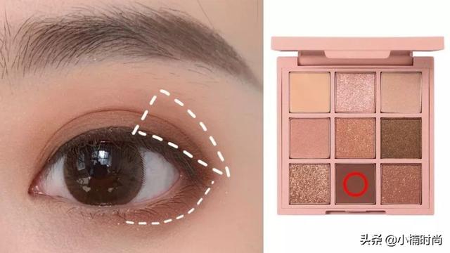 医我看｜关于基孔肯雅热传播、防控和康复，珠海专家这样说→